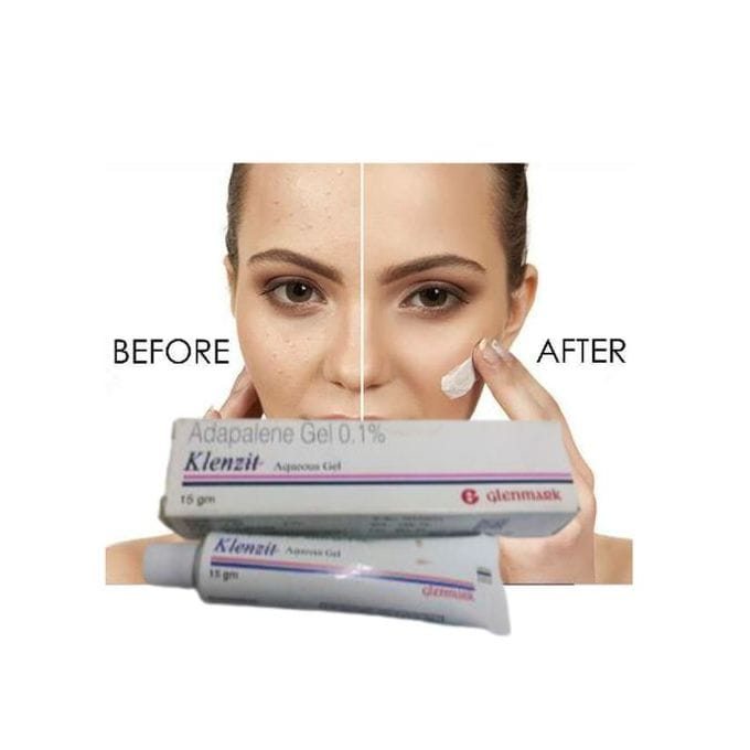 ACNES Klenzitt Gel Adapalene Acne Gel - Treat Acnes, Pimples