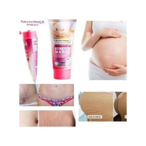 Fruit Of The Wokali Wokali Stretch Marks Remover Cream- 130ml.